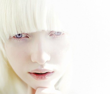 Анастасия жидкова альбинос