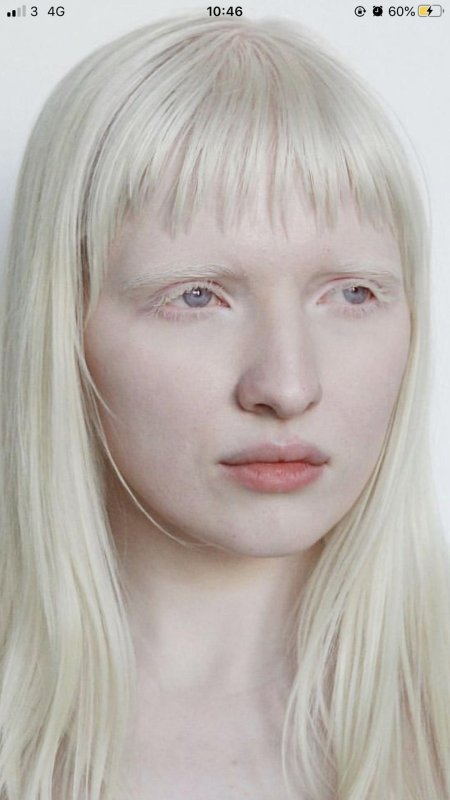 Настя кусакина альбинос