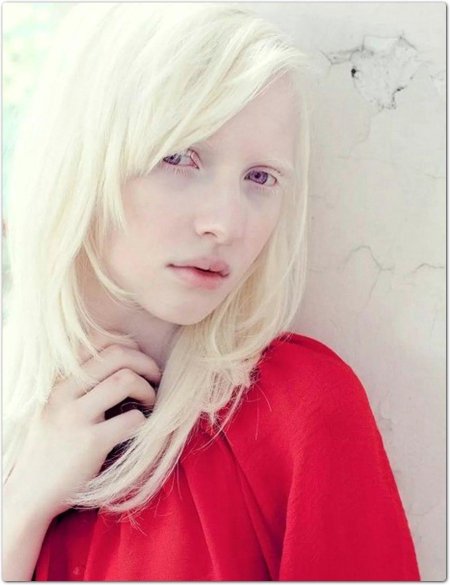 Настя жидкова альбинос