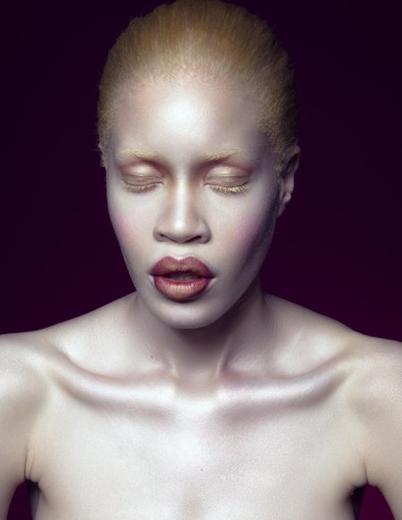 Диандра форрест