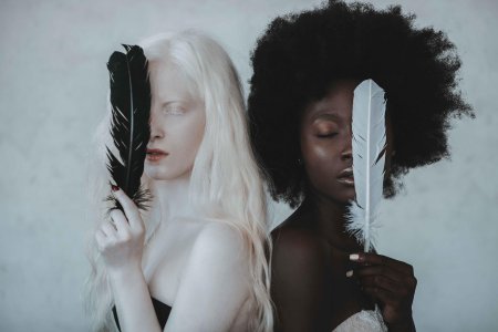 Девушка альбинос