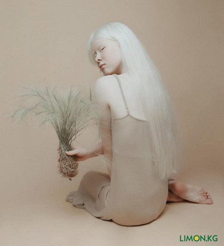 Асель калаганова альбинос