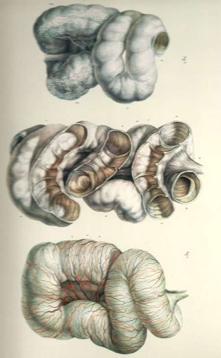 Поперечная ободочная кишка анатомия