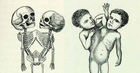 Двухголовый человек скелет