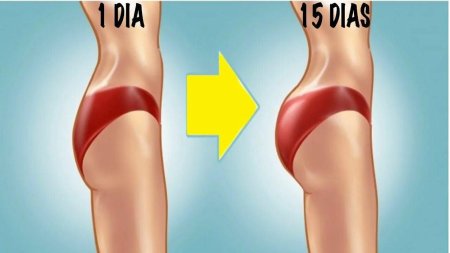 Плоские ягодицы