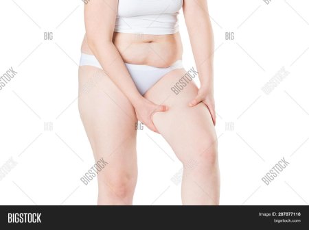 Лишний вес на бедрах