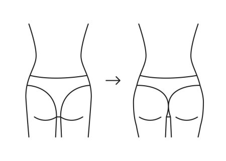 Плоские ягодицы