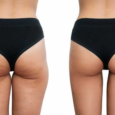 Галифе на бедрах