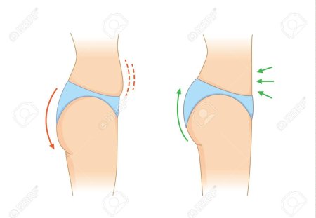 Плоские ягодицы