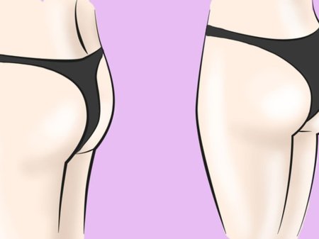 Плоские ягодицы