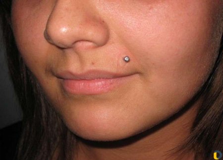 Гранулема пирсинг Монро