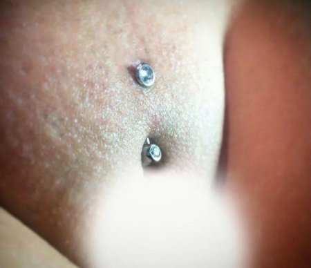 Поверхностный пирсинг