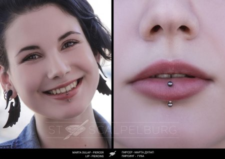 Вертикальный лабрет нижней губы шрам