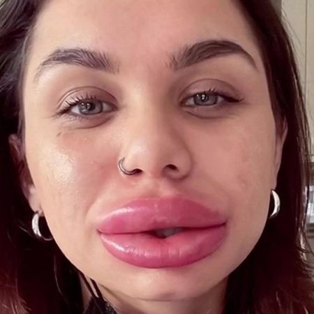 Накаченные губы