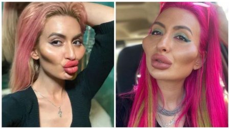 Настя Покрещук до пластики