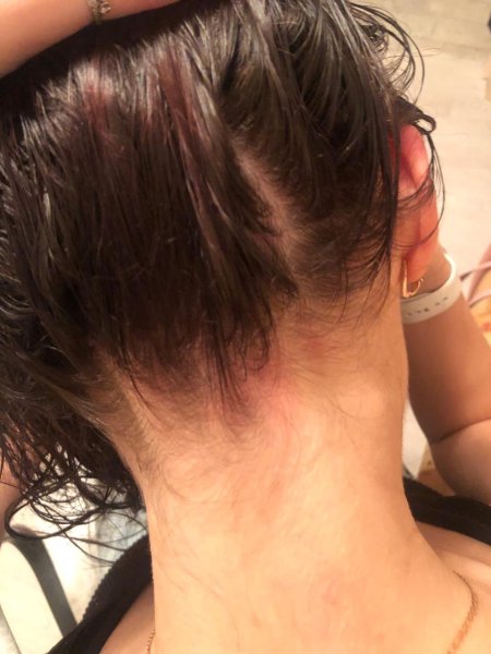 Волосы на затылке