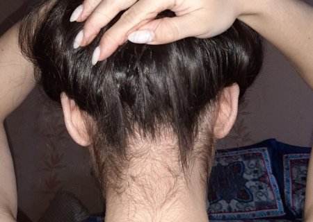 Линия роста волос на затылке