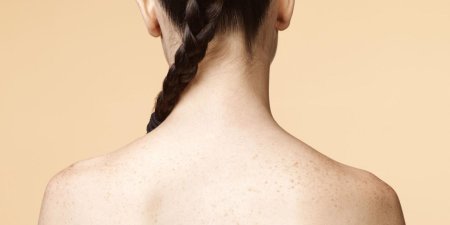 Волосы на спине у девушек