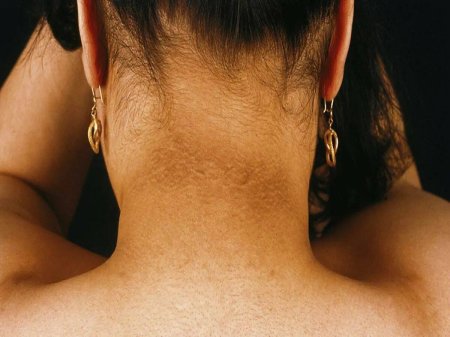 Волосы на шее
