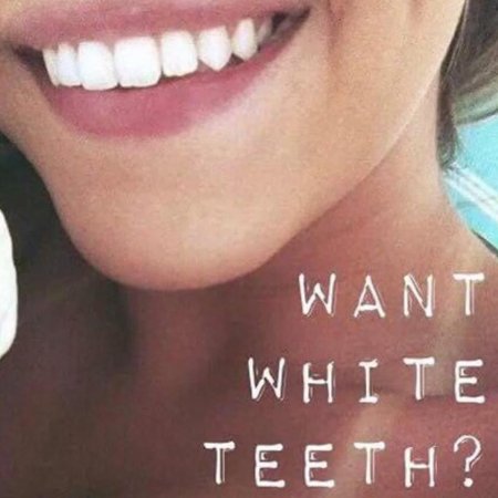 Красивая улыбка