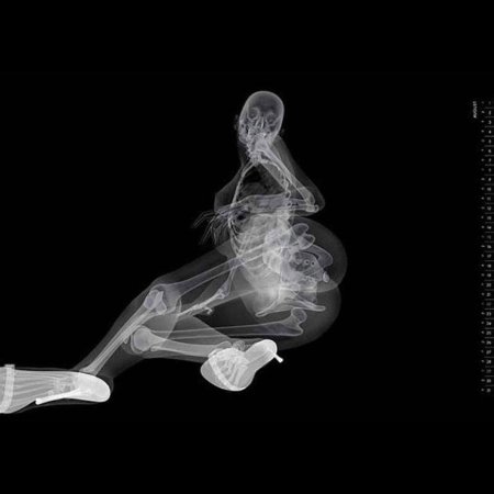 Смешные рентгеновские снимки