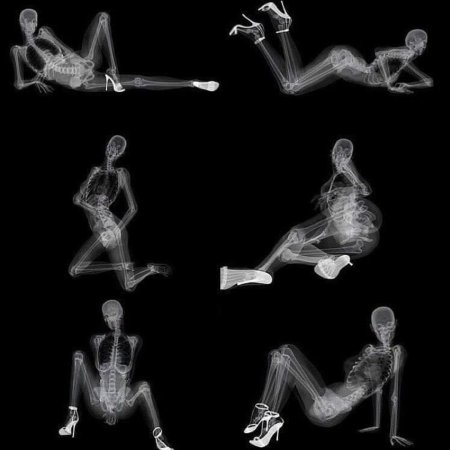 Рентген вк7201к