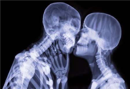 Рентгеновский снимок