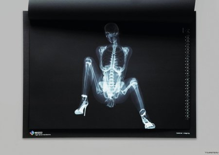 Рентгеновский снимок человека