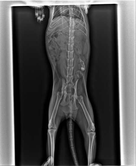 Рентген женщины