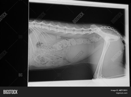 Рентгеновский снимок девушки