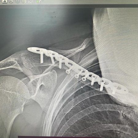 Рентген девушки