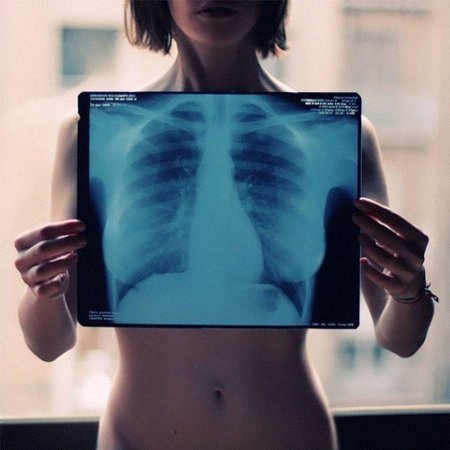 Рентген девушки