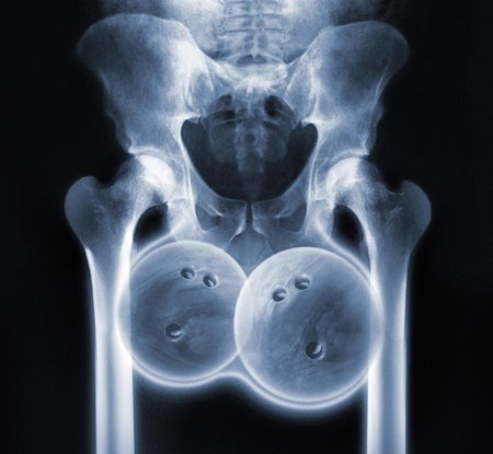 Прикольные рентгеновские снимки