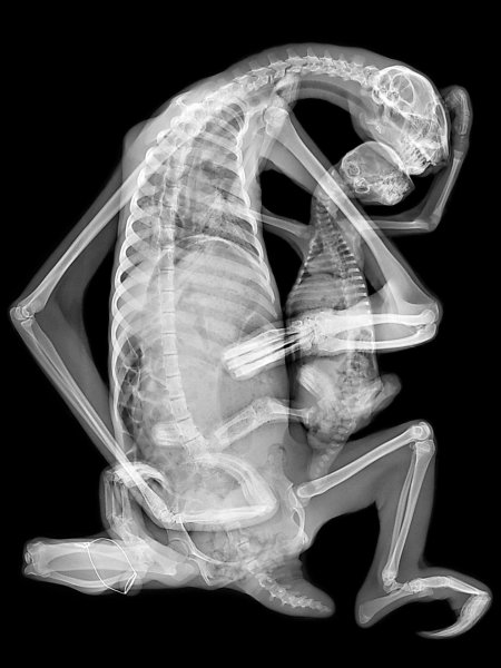 Рентгеновский снимок