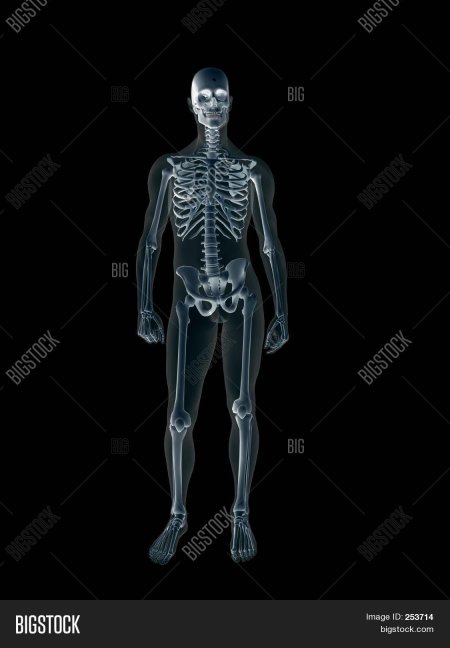 Рентген человека