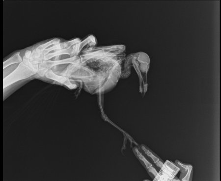 Рентген девушки