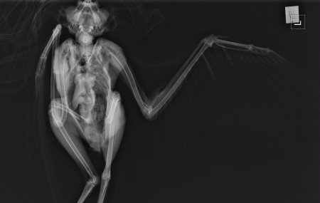 Рентгеновский снимок