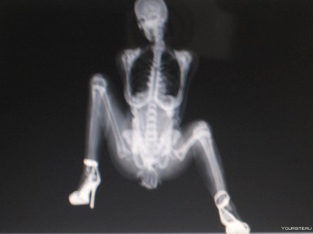 Рентгеновские снимки