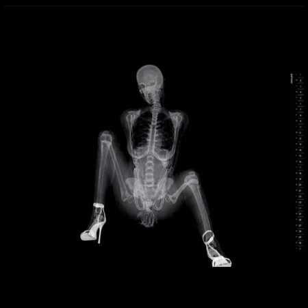 Рентгеновские снимки женщин