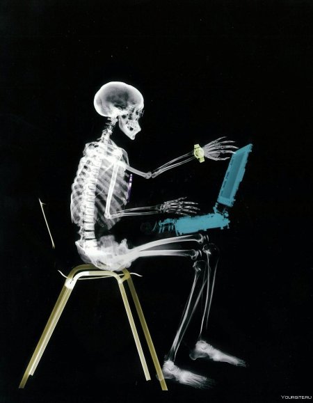 Рентгеновский снимок человека