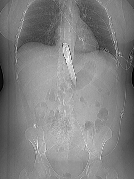 Рентгеновские снимки