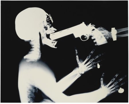 Рентген человек