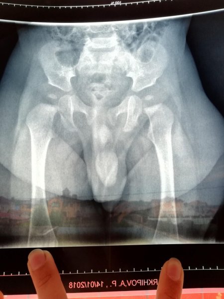 Рентгеновские снимки