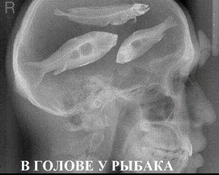 Рыба рентген
