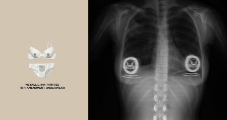 Смешные рентгеновские снимки