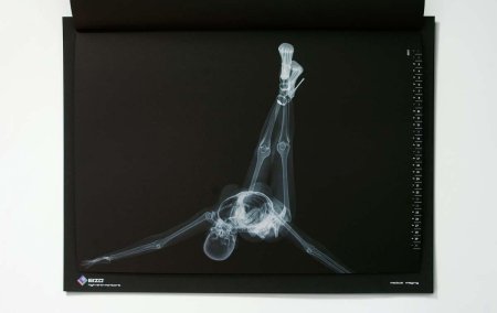 Рентгеновские снимки