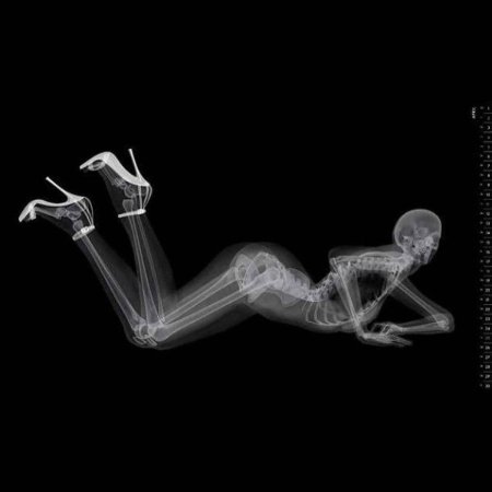 Рентген скелета