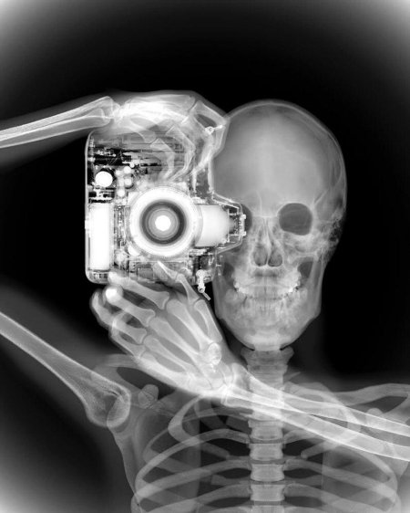 Рентгеновский снимок