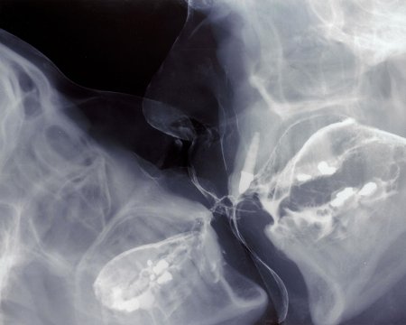 ВИМ Дельвуа поцелуй