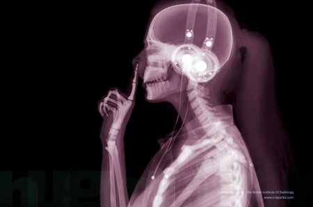 Рентгеновский снимок